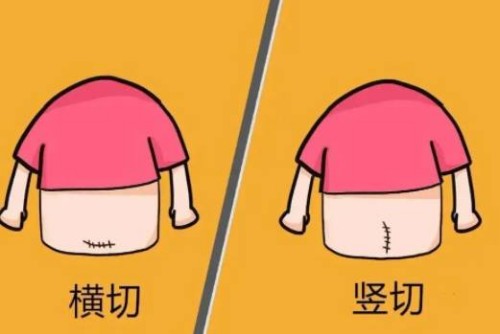 备孕打碱性针能提高生男孩的几率，内附注射碱性针的最佳时期_1